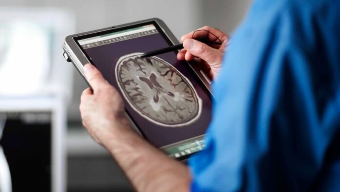 Beyond memory pills: Why activities of daily life ADL training Beyond memory pills: Why activities of daily life ADL training matters in Alzheimers diseasecare